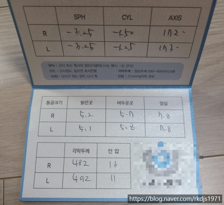  [라섹] 구로 ㅅㅇㅇㅅ안과 라섹 2달 후기