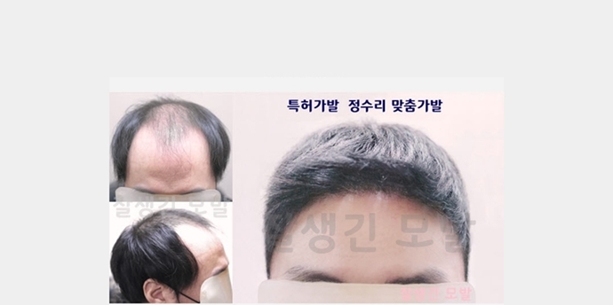  남자짧은머리가발 앞머리 신촌가발 은평구