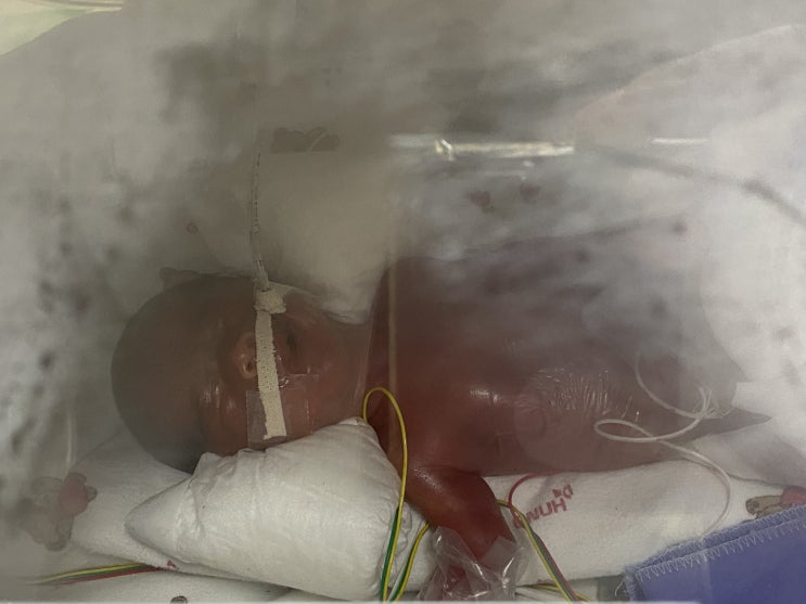 30대 임산부 보호자 일기 D-92일 26주 조산 30대 임산부 보호자 일기 D-92일 26주 조산