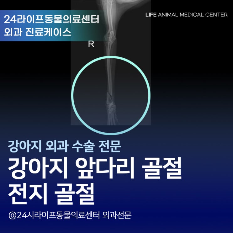 대구 강아지 앞다리 골절수술 : 쇼파에서 떨어지며 팔이 부러졌어요. 24시라이프동물의료센터