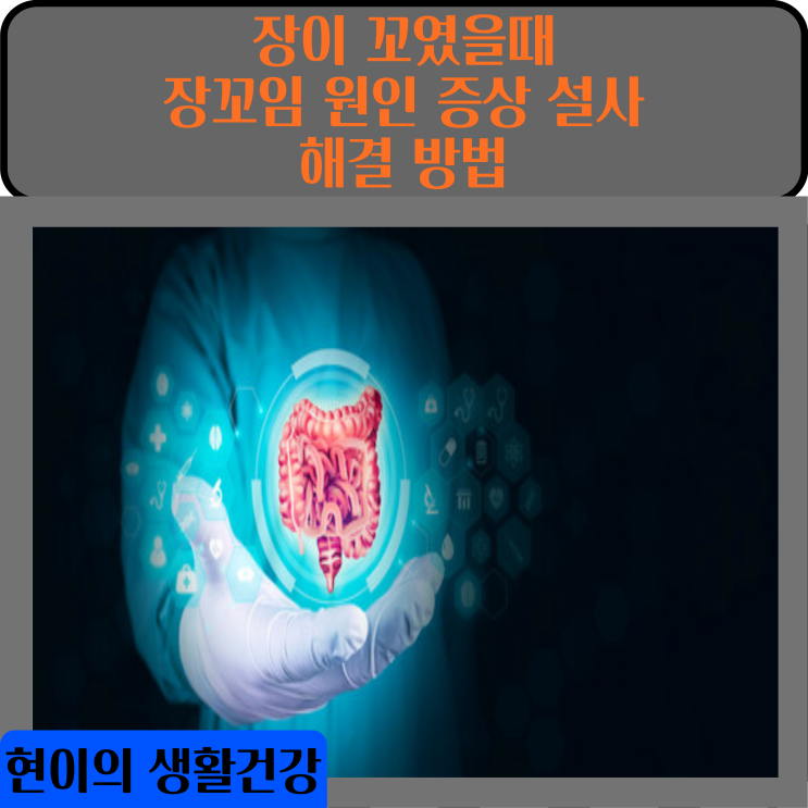  장이 꼬였을때 장꼬임 원인 증상 설사 해결 방법