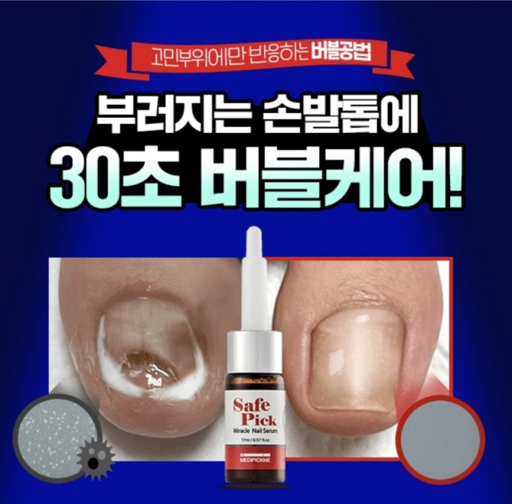  10월30일 10시30분 메디픽미 버블 네일세럼 캐시워크 정답 ㅋㅇㅇㄹㅇ / ㅋㅌㅅ / ㅇㅎ / ㅂㅅㄱ