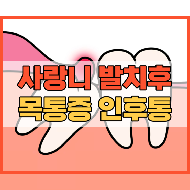  사랑니 발치후 목통증 인후통 왜 나타날까요?