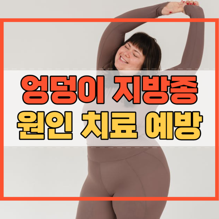  엉덩이 지방종 원인 및 치료 예방 방법!