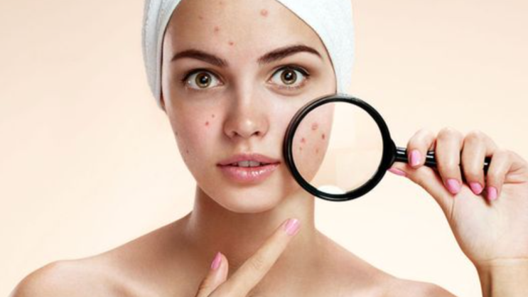 얼굴 접촉성 피부염: 증상, 대처법, 자연치유, 관리, 연고 선택까지