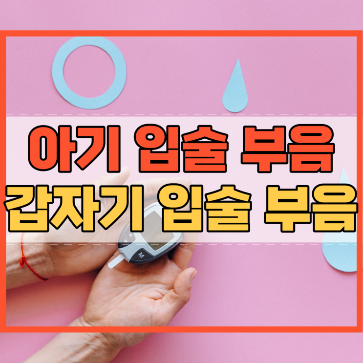  아기 입술 부음 및 갑자기 입술이 붓는 현상 왜 그럴까요?