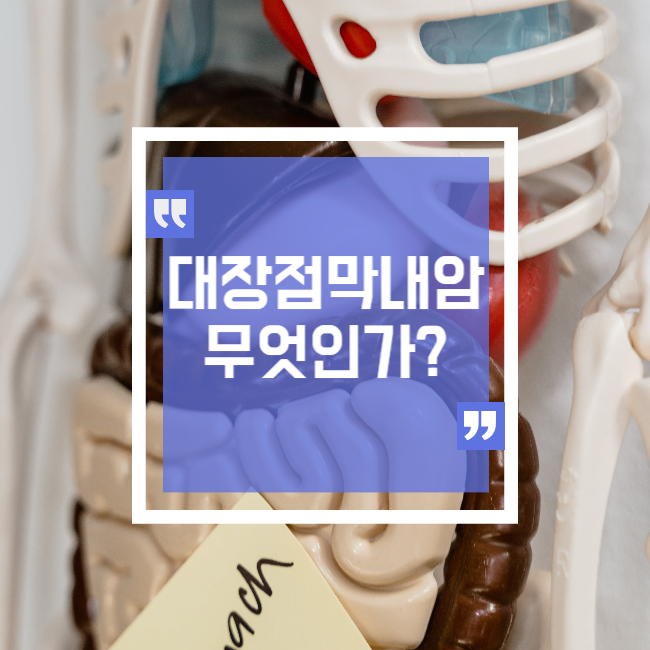  대장 점막내암은 무엇인가?