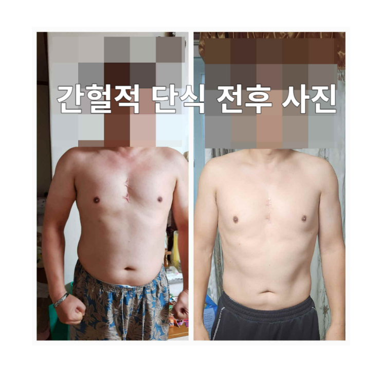  OOO식이요법 한 달에 5kg 감량과 건강을 동시에 간헐적 단식
