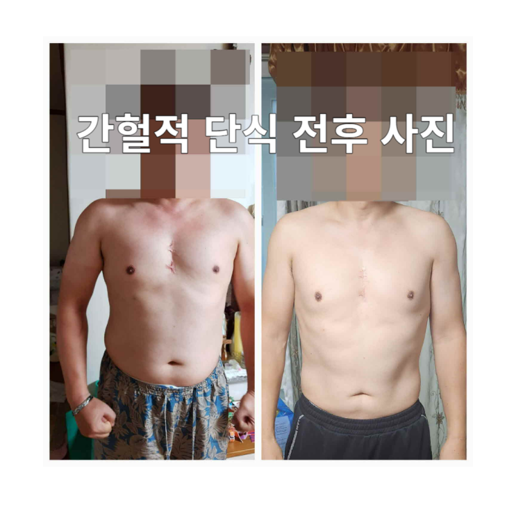 OOO식이요법 한 달에 5kg 감량과 건강을 동시에 간헐적 단식