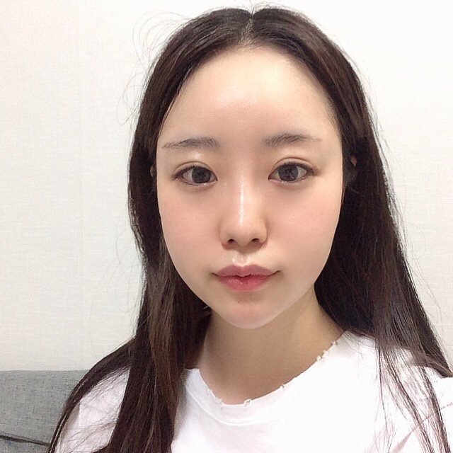  c"여자친구"가 더 예뻐진다면? [눈성형,코성형+얼굴지방이식]  c