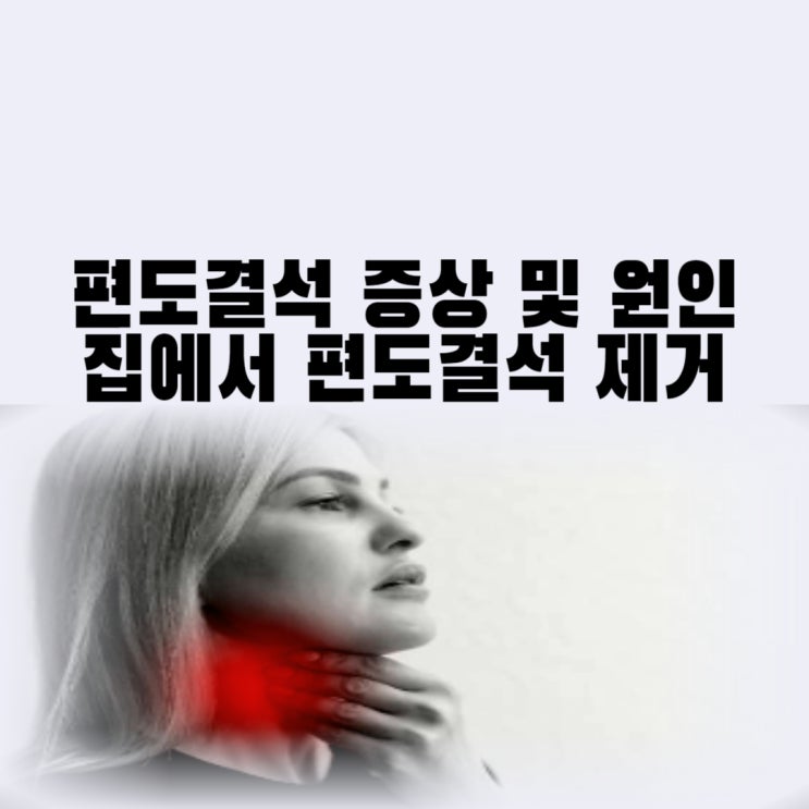 집에서 편도결석 쉽게 빼는법 편도결석 제거 원인 및 증상 치료 예방