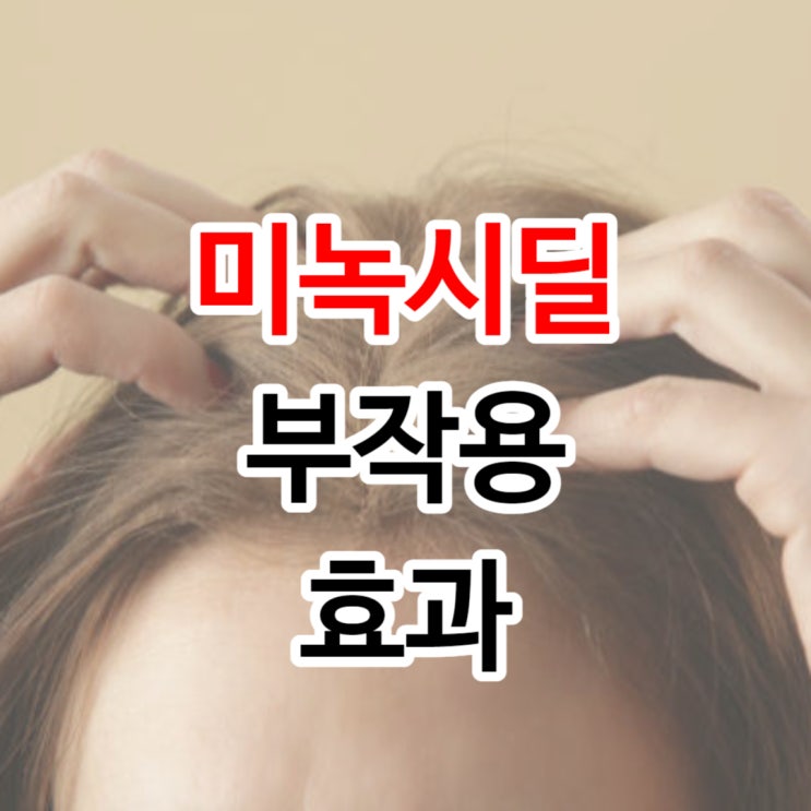  미녹시딜 부작용 여자 5% 효과