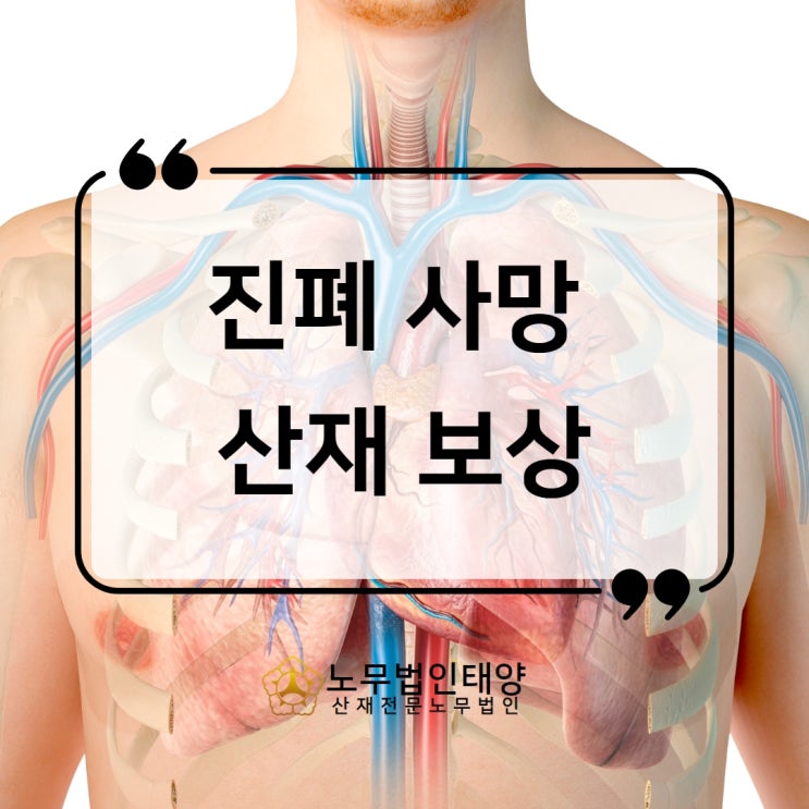 진폐 사망 보상, 가족 배우자 산재 입증하는 방안에 대하여