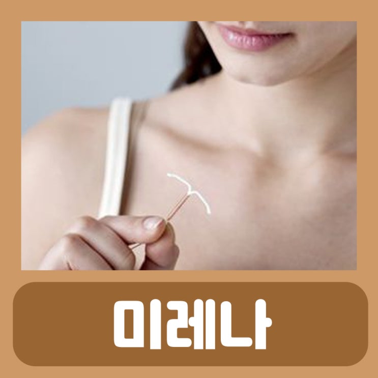  미레나 시술 부작용 보험 비용 체중증가 제거