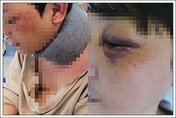  김포 폭행 구래동 아파트 학부모 사건