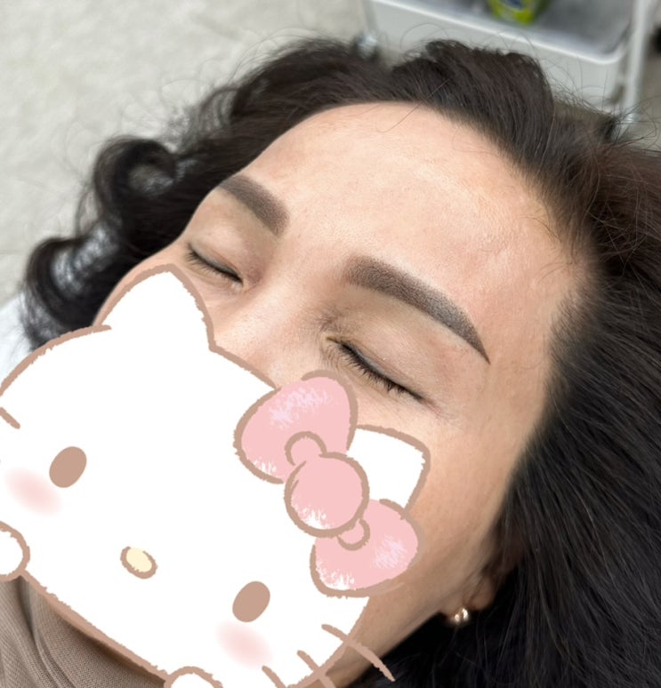  전주눈썹문신제거후 예쁜눈썹으로 변신