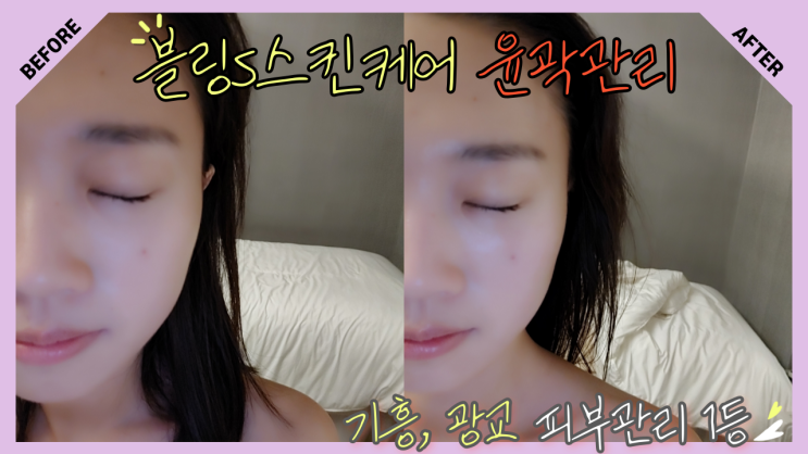  기흥 & 광교 피부관리 블링S스킨케어 윤곽관리 추천