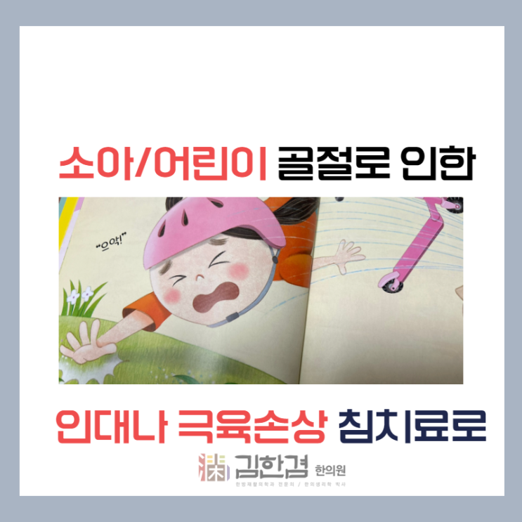  킥보드로 인한 골 어린이 골절 시 침치료로(feat 쿵! 뼈를 다쳤어요)