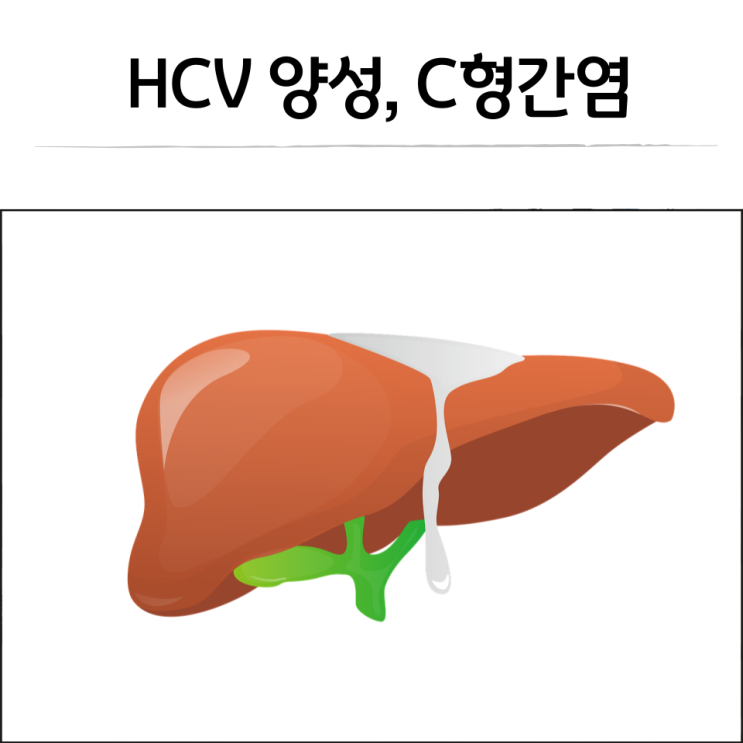 HCV 양성, 임산부에 미치는 영향, 예방법 알아보기