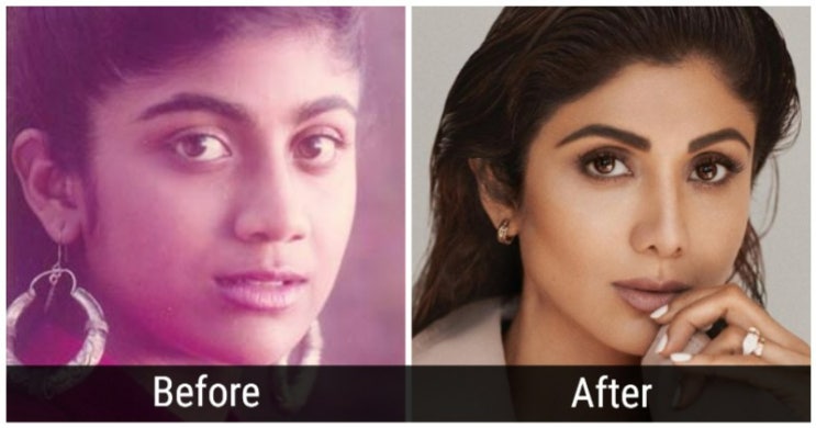 인도 발리우드 여배우들의 성형 수술 전과 후