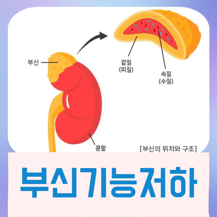  부신기능저하 이유 대표적 증상과 피로도 예방