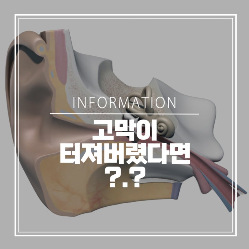 고막이 터져버린다면 ? I 건강정보