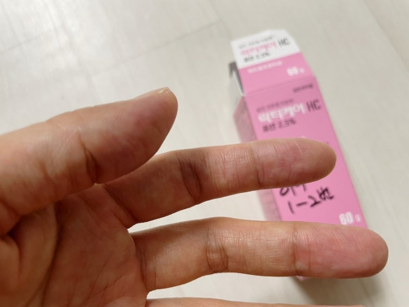 대환장 주부습진 한포진 콜라보 / 공릉동 이준영 피부과