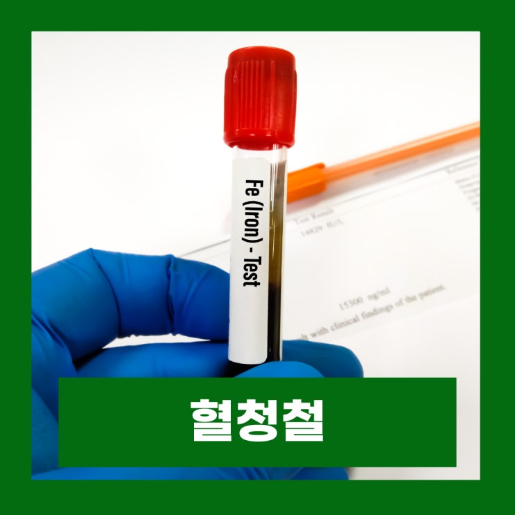  혈청철 수치 높음 낮음 원인 증상 해결방법 훼리틴 정상수치