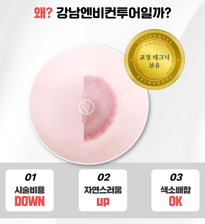  유륜타투 유방암 디자인 재건 잘하는 곳은 어디