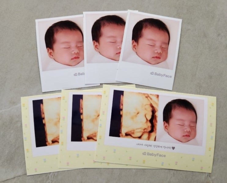 입체초음파로 실제 아기얼굴 예측! 베이비페이스 후기(내돈내산) 입체초음파로 실제 아기얼굴 예측! 베이비페이스 후기(내돈내산)