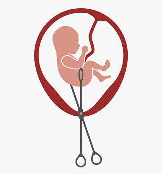  임신중절수술 낙태 방법과 주의사항 합병증