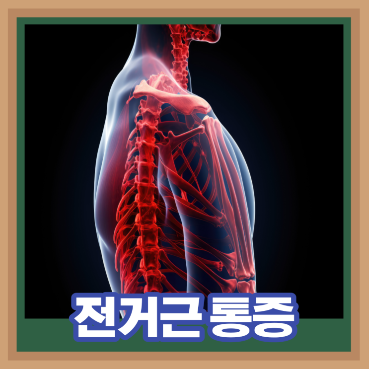  전거근 강화운동 전거근 기능 위치 통증 치료 스트레칭