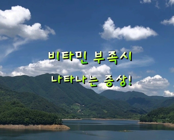 비타민 부족시 나타나는 증상! 비타민 부족시 나타나는 증상!