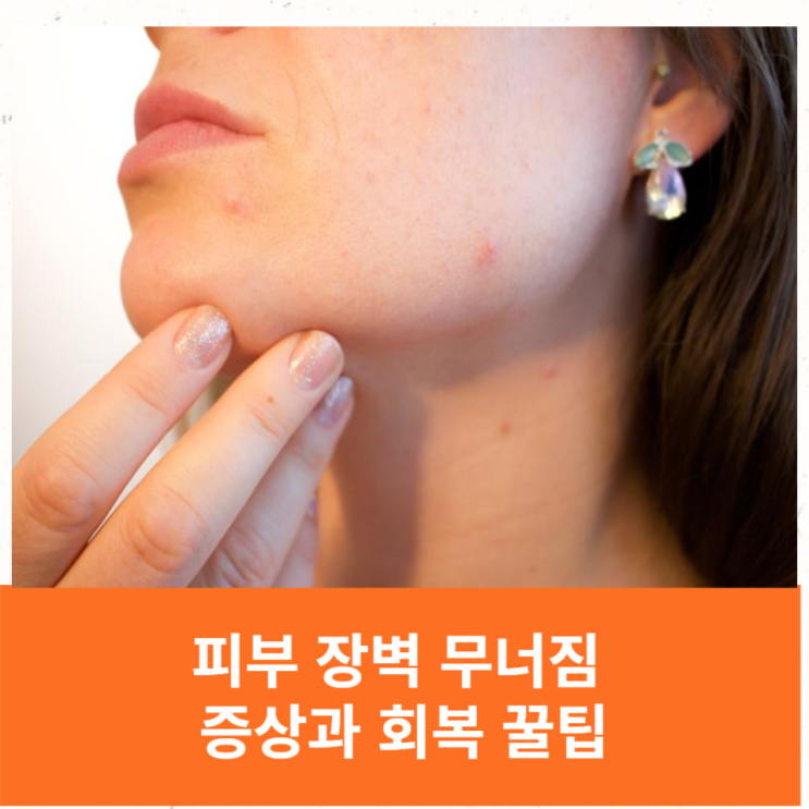  피부장벽 무너짐 -증상, 회복 꿀팁