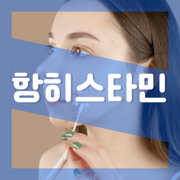  항히스타민 연고 종류 : 빈대 물림 가려움 알러지 두드러기 염증 치료법