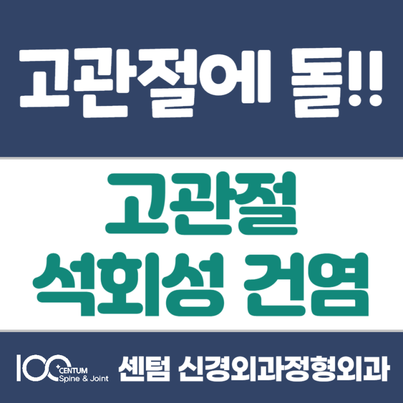 고관절 통증이 심하다면??고관절석회성건염