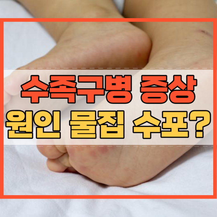  수족구병 증상 원인 입안 입술 물집 손등 손가락 손바닥 발에 피부 몸에 수포!
