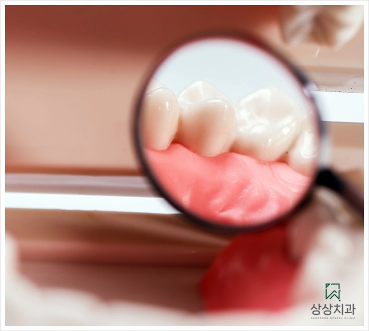  잇몸성형수술? 치주과 전문의 대표원장이 정리 해드립니다.