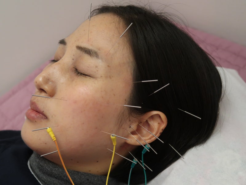 부산안면신경마비 구안와사치료 한의원