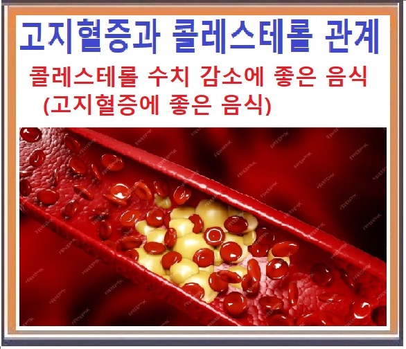  고지혈증 과  콜레스테롤 수치 감소에 좋은 음식 /고지혈증과 콜레스테롤 관계에 대해 알아보기