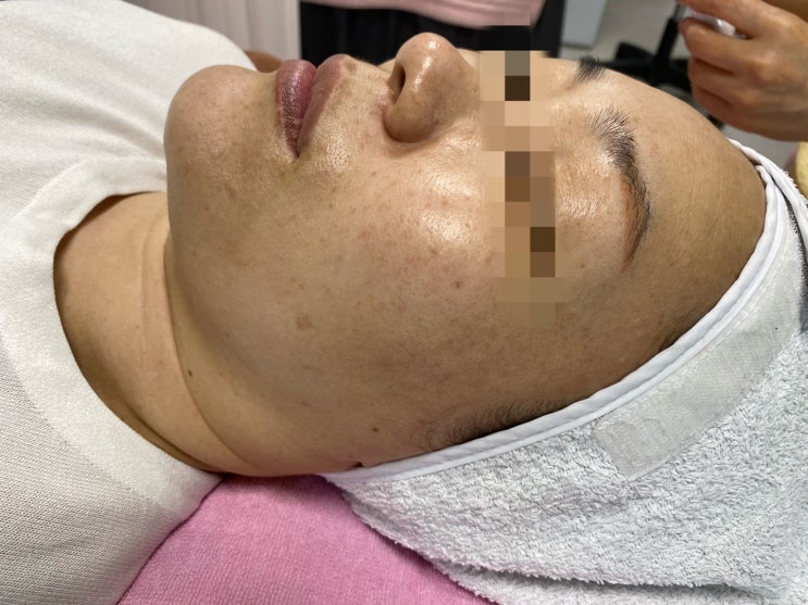  고잔동피부샵 얼굴이 밝아진 피부연구소