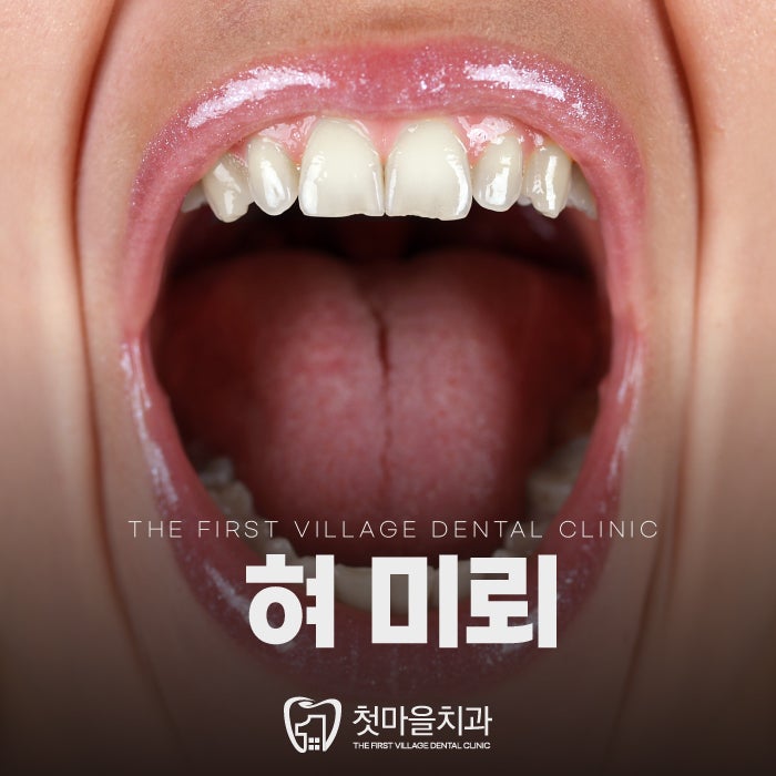 혀 미뢰, 조그만 맛봉오리 이야기