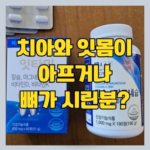  치아와 뼈 건강에 좋으면서도 항산화 성분도 함유한 치과의사의 잇타민 소개