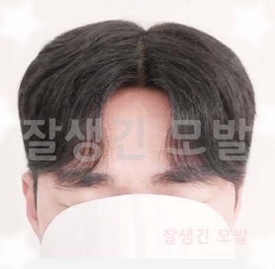  안양가발 평촌 모발이식가발 장발 남자유행머리