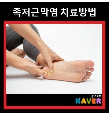 족저근막염 치료 방법 : 깔창 스트레칭 소염제 프롤로 DNA 주사