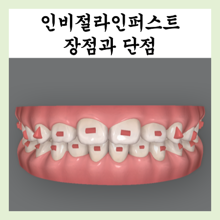 인비절라인 퍼스트로 어린이 치아교정, 장점과 단점?