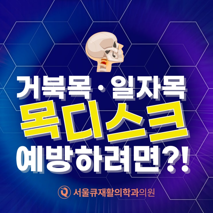  석촌역거북목, 만성통증 일으키는 대표적인 원인은?
