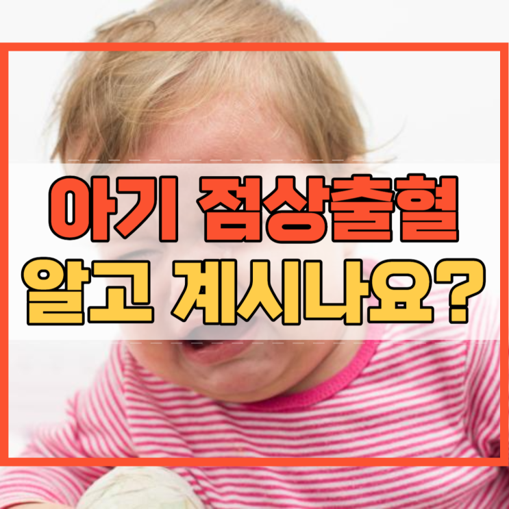  아기 점상출혈 알고 계시나요?
