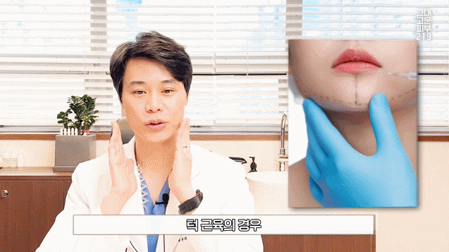 센텀 사각턱보톡스 맞아도 절대 갸름해지지 않는 이유? 센텀 사각턱보톡스 맞아도 절대 갸름해지지 않는 이유?