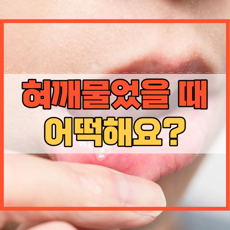  혀 깨물었을때 어떻게 해야 할까요?